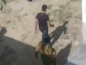 फटे होंठ और लंबे सेक ...