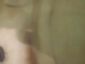 बालों और गन्दा ओरल प ...